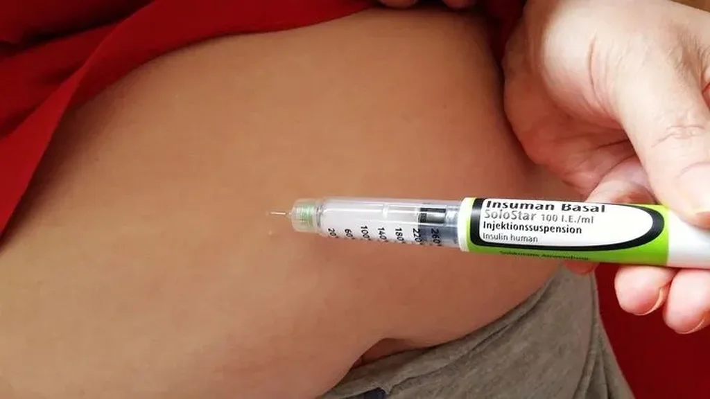 Insulinex - Hrvatska - rezultati - sastav - gdje kupiti - narudžba - u ljekarnama - iskustva - cijena - recenzije
